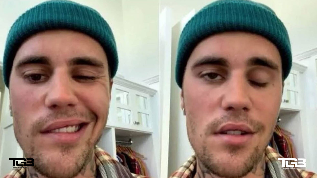 Justin Bieber reappears after suffering from facial paralysis and smiles again